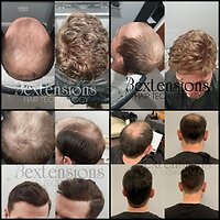 Bextensions. MALEHAIR